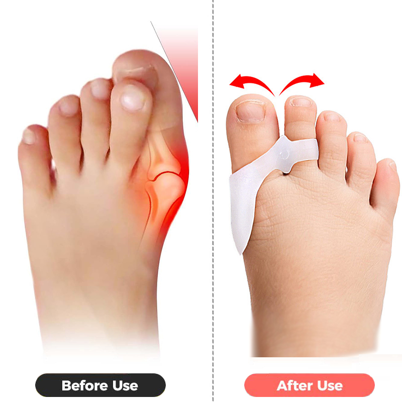 Pexmen 2/4Pcs Toe Spacers Buni - огляд і ціна Power Tools Kids